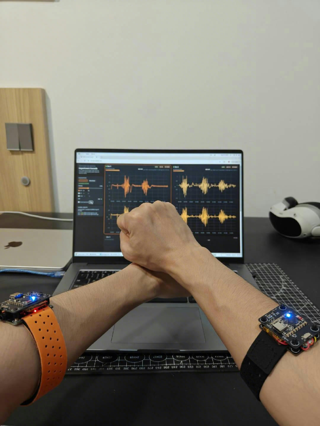 Two arms wearing AAW sEMG Wireless modules with live EMG waveforms in AAW Lab Console