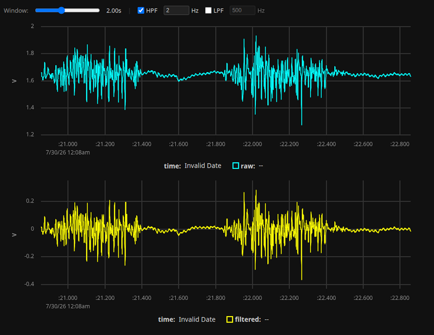 Dry electrode EMG waveform capture