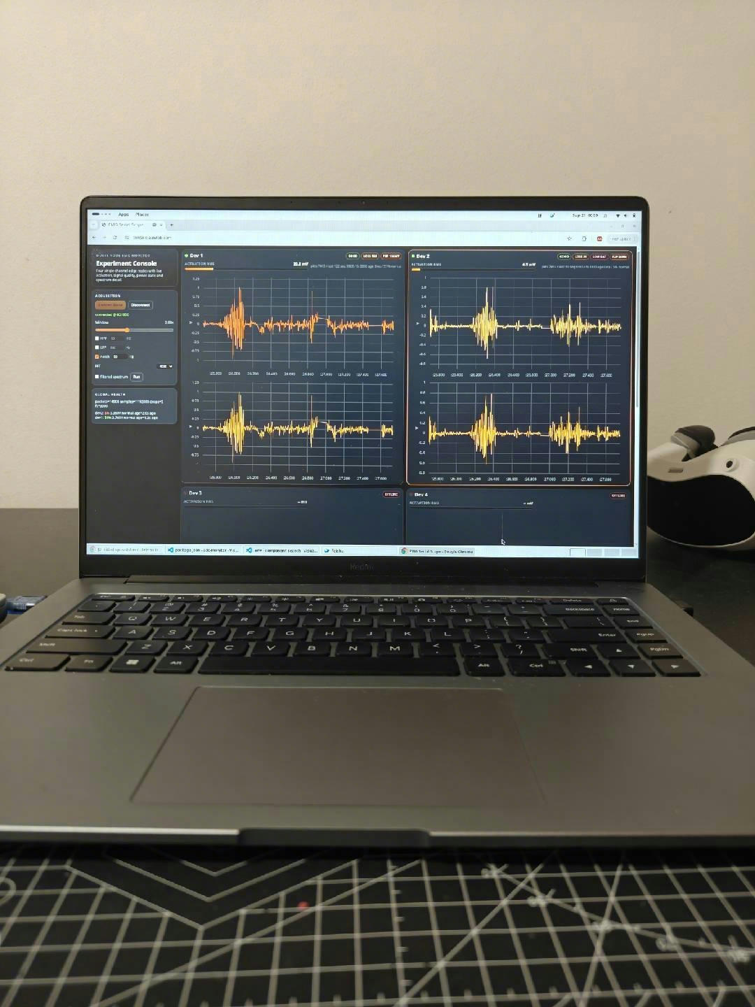 AAW Lab Console EMG waveform website screenshot