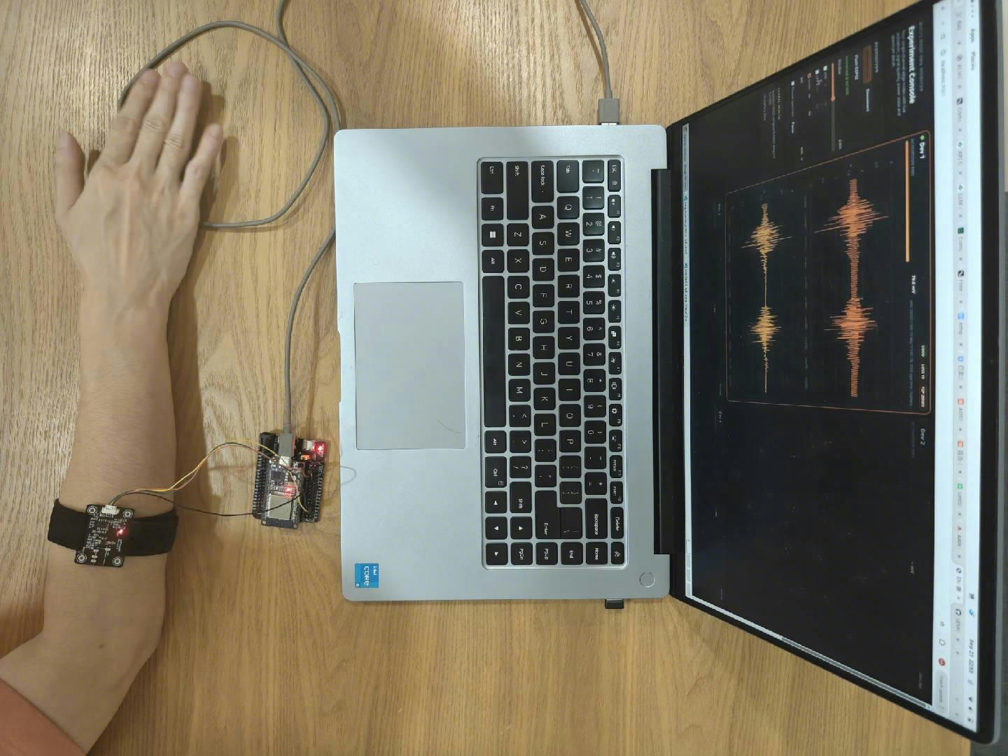 AAW sEMG Flex worn on an arm, connected to an ESP32 DevKit and laptop waveform display